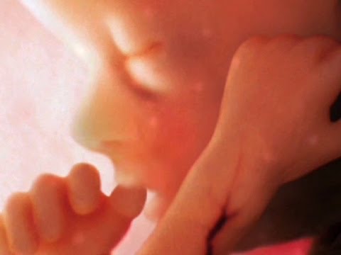 アレグザンダー・シアラス: 受胎から誕生までを可視化する