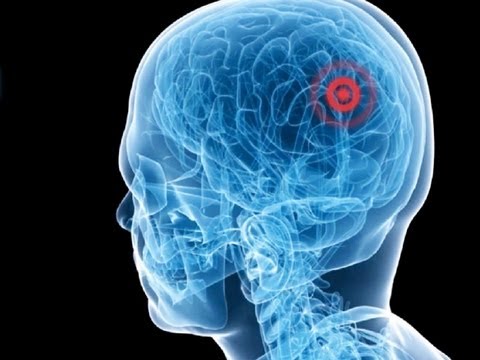 ヨアヴ・メダン: 超音波手術―切らずに治療する